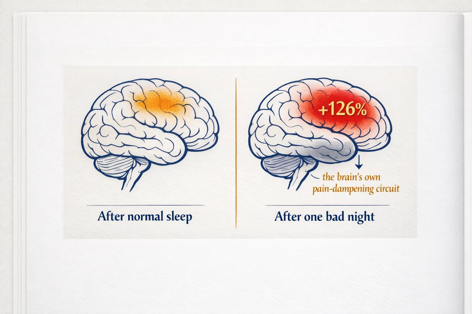 Editorial illustration comparing brain activity after normal sleep and after one bad night with a plus 126 percent callout